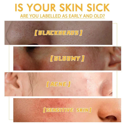 Honey Glow Peel Mask