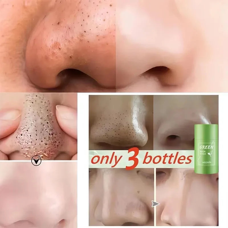 Green Tea Blackhead Stick